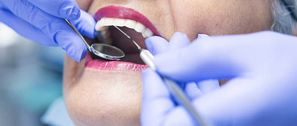 Best Urgent Care for Lost Fillings or Crowns in Centennial, CO
